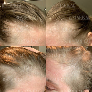 Struggling with Hair Thinning or Shedding? Discover the Power of Nature with Botanical Green Lab