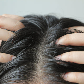 Fight Hair Loss: Dandruff vs. Dry Scalp