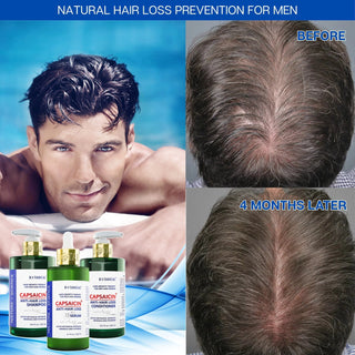 Capsaicin Anti Hairloss Shampoo for Hair Growth and Hair Thinning PreventionScalp-Stimulating & Follicle Strengthening by Botanical Green Lab