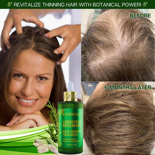 Botanical Green Lab Lemongrass Rosemary Hair Growth Treatment for hair loss hair thinning prevention before and after