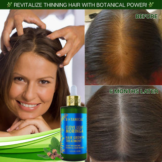Botanical Clove Leaf Moringa hair growth treatment for hair loss before-and-after hair images