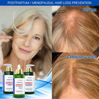 Conditioner For Thinning Hair -  Capsaicin Dandruff & Hair Thinning Prevention Formula