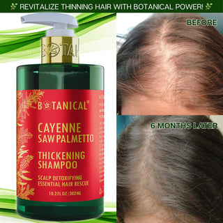 cayenne saw palmetto shampoo for hair loss before and after