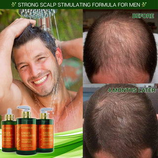 Botanical Ginger & Saw Palmetto Thickening Shampoo for hair loss and hair thinning prevention for men before and after