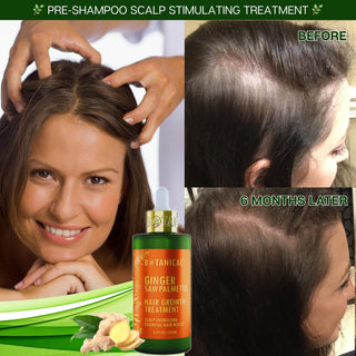 Ginger & Saw Palmetto Hair Growth Treatment for hair loss and hair thinning prevention 