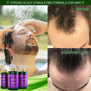 Lavender Hair Growth Shampoofor hair loss and hair thinning prevention before and after Calming & Strengthening Formula by Botanical Green Lab 